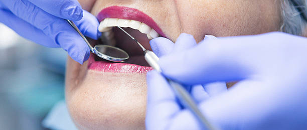 Best Emergency Broken Tooth Repair in Old Greenwich, CT
